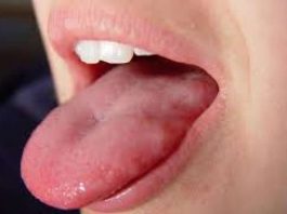 मुखको क्यान्सर : बढ्दो रोग, जटील उपचार : डा.प्रभात चन्द्र ठाकुर